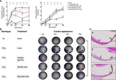 Targeted delivery of autoantigen to dendritic cells prevents development of spontaneous uveitis